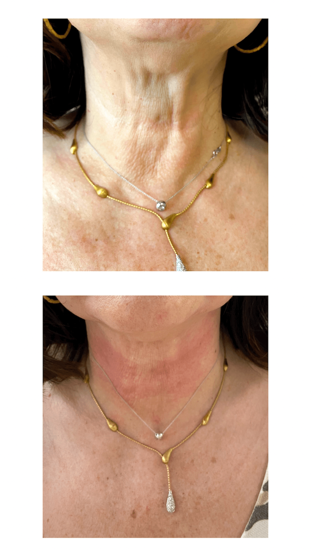 Cuello Cuello