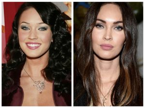 bolas de bichat antes y despues Megan Fox