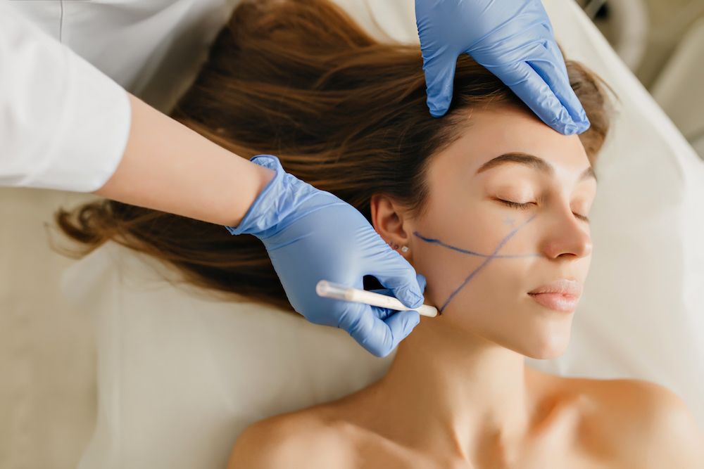 Bichectomía facial Bichectomía facial