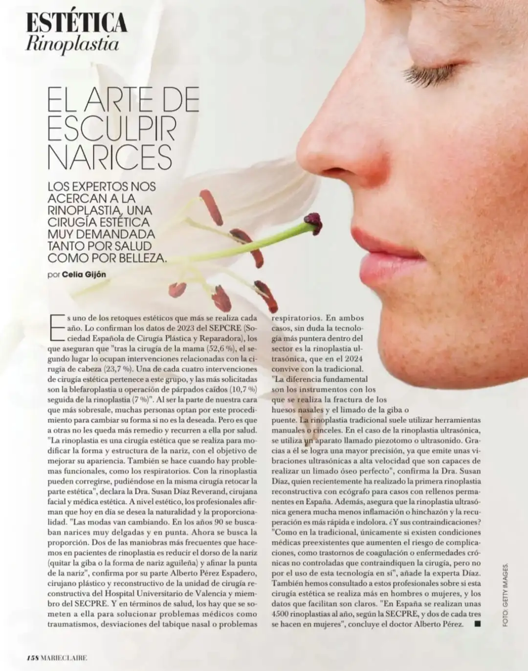 Marie-claire-Susan-Díaz-reverand-rinoplastia