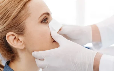 Rinoplastia ultrasónica postoperatorio